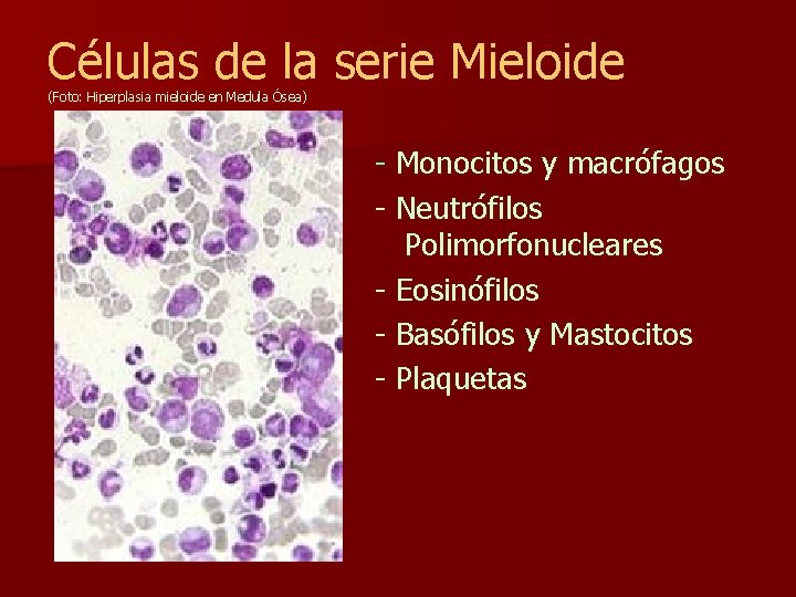 Células de la serie Mieloide (Foto: Hiperplasia mieloide en Medula Ósea) - Monocitos y