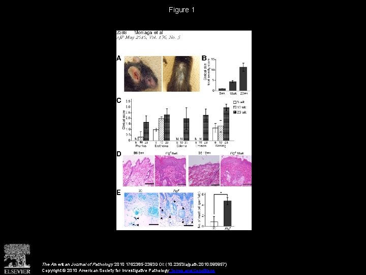 Figure 1 The American Journal of Pathology 2010 1762385 -2393 DOI: (10. 2353/ajpath. 2010.