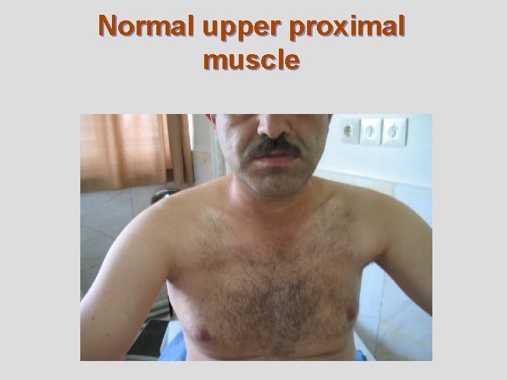 Normal upper proximal muscle 