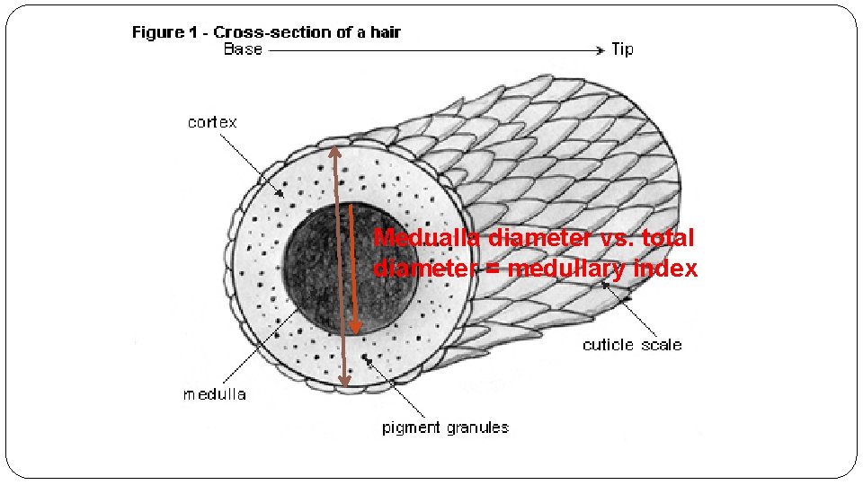 Medualla diameter vs. total diameter = medullary index Medualla diameter vs. total diameter = medullary index