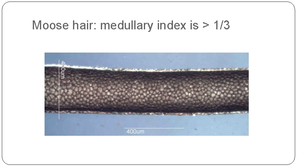 Moose hair: medullary index is > 1/3 Moose hair: medullary index is > 1/3