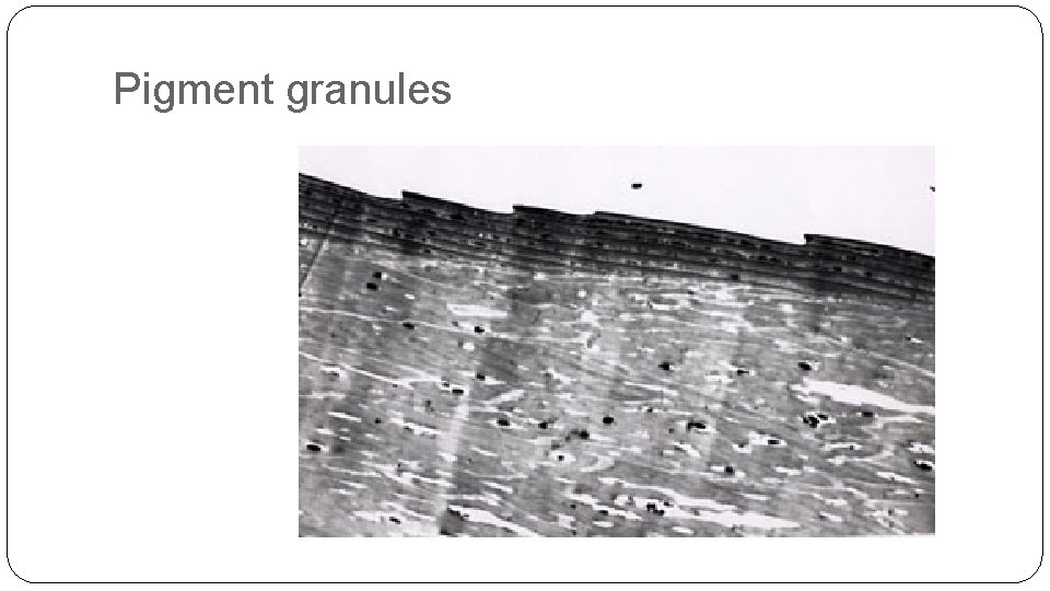 Pigment granules Pigment granules