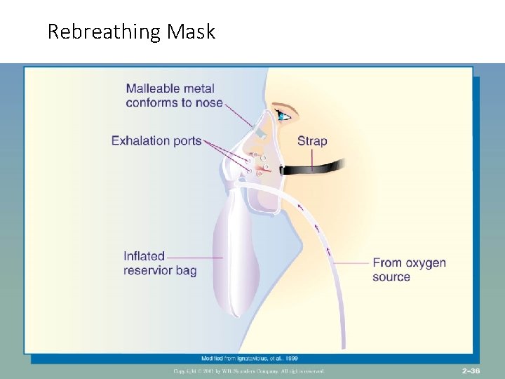 Rebreathing Mask 