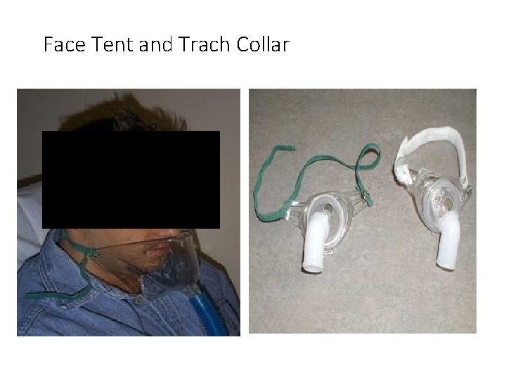 Face Tent and Trach Collar 