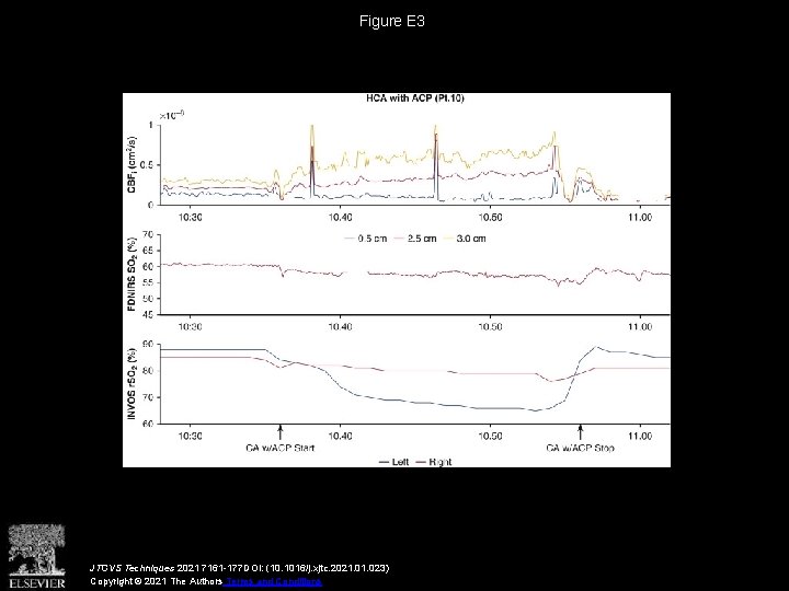 Figure E 3 JTCVS Techniques 2021 7161 -177 DOI: (10. 1016/j. xjtc. 2021. 023)
