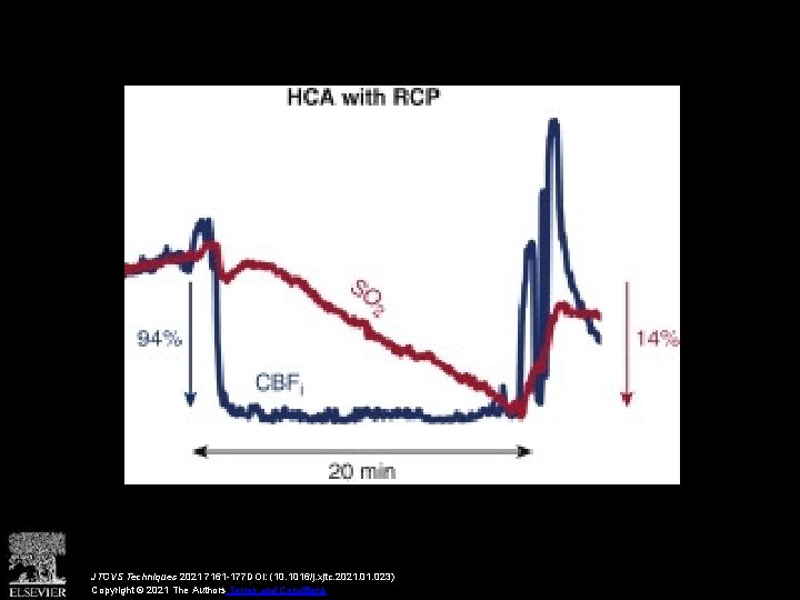 JTCVS Techniques 2021 7161 -177 DOI: (10. 1016/j. xjtc. 2021. 023) Copyright © 2021