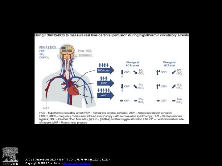 JTCVS Techniques 2021 7161 -177 DOI: (10. 1016/j. xjtc. 2021. 023) Copyright © 2021