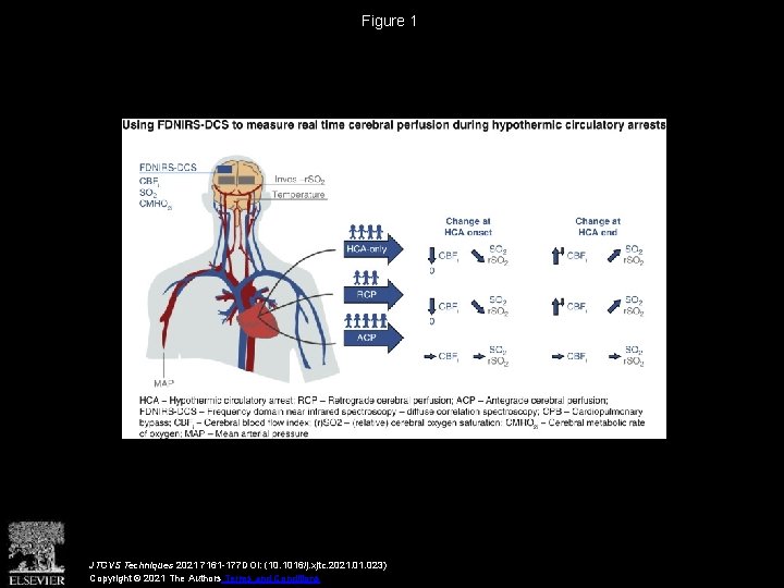 Figure 1 JTCVS Techniques 2021 7161 -177 DOI: (10. 1016/j. xjtc. 2021. 023) Copyright
