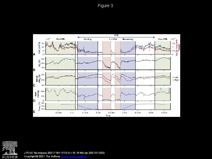 Figure 3 JTCVS Techniques 2021 7161 -177 DOI: (10. 1016/j. xjtc. 2021. 023) Copyright