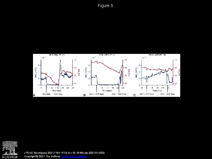 Figure 5 JTCVS Techniques 2021 7161 -177 DOI: (10. 1016/j. xjtc. 2021. 023) Copyright