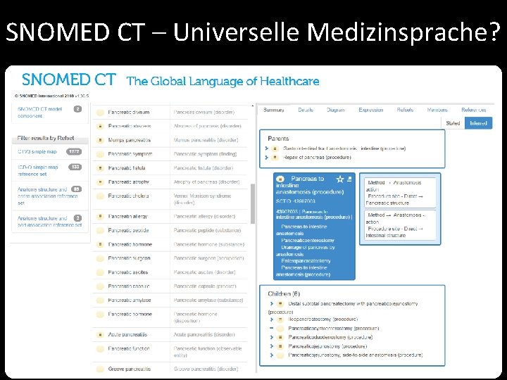 SNOMED CT – Universelle Medizinsprache? 