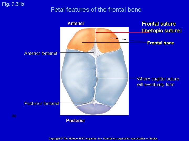 Fig. 7. 31 b Fetal features of the frontal bone Anterior Frontal suture (metopic