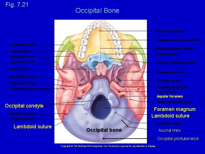 Fig. 7. 21 Occipital Bone Incisive foramen Palatine process of maxilla Zygomatic bone Median