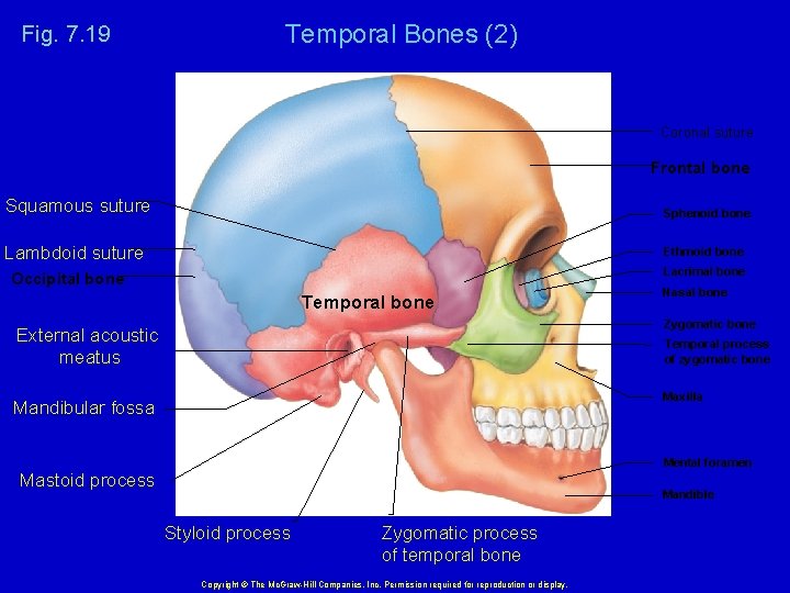 Fig. 7. 19 Temporal Bones (2) Coronal suture Frontal bone Squamous suture Sphenoid bone