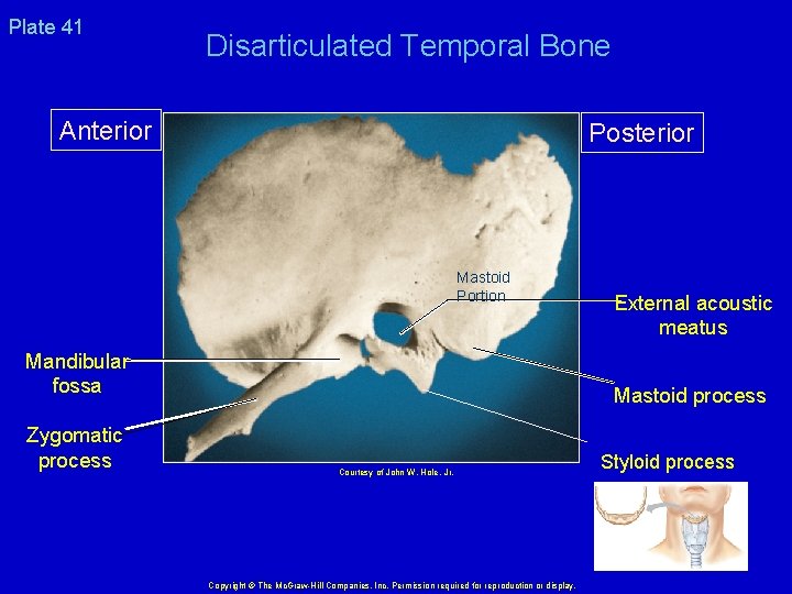 Plate 41 Disarticulated Temporal Bone Anterior Posterior Mastoid Portion Mandibular fossa Zygomatic process External