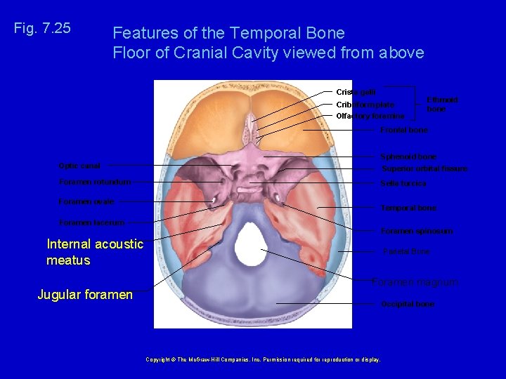 Fig. 7. 25 Features of the Temporal Bone Floor of Cranial Cavity viewed from