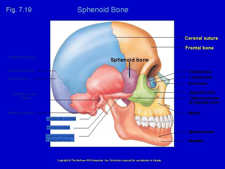 Sphenoid Bone Fig. 7. 19 Coronal suture Frontal bone Squamous suture Sphenoid bone Lambdoid