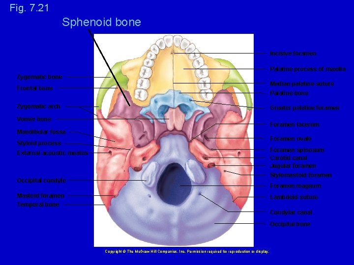Fig. 7. 21 Sphenoid bone Incisive foramen Palatine process of maxilla Zygomatic bone Median
