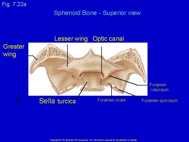 Fig. 7. 22 a Sphenoid Bone - Superior view Lesser wing Optic canal Greater