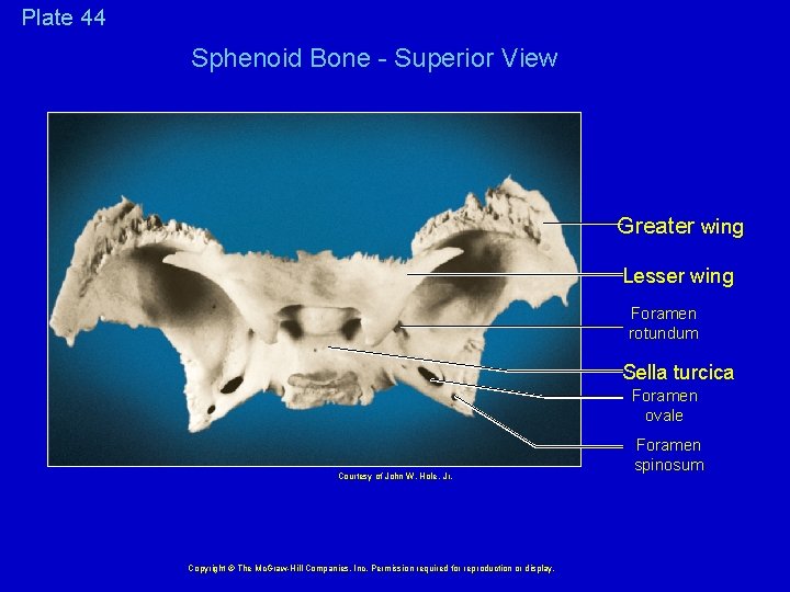Plate 44 Sphenoid Bone - Superior View Greater wing Lesser wing Foramen rotundum Sella