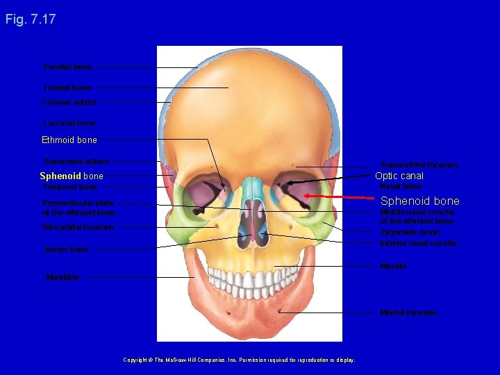 Fig. 7. 17 Parietal bone Frontal bone Coronal suture Lacrimal bone Ethmoid bone Squamous
