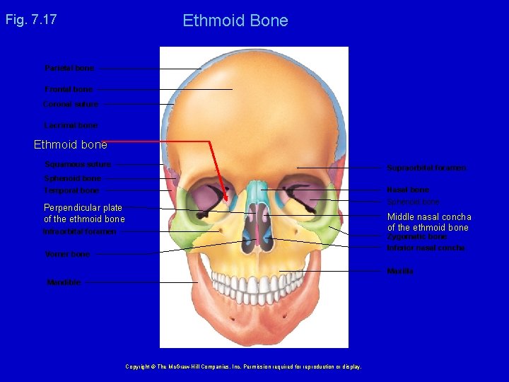 Fig. 7. 17 Ethmoid Bone Parietal bone Frontal bone Coronal suture Lacrimal bone Ethmoid