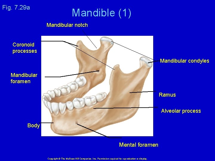 Fig. 7. 29 a Mandible (1) Mandibular notch Coronoid processes Mandibular condyles Mandibular foramen