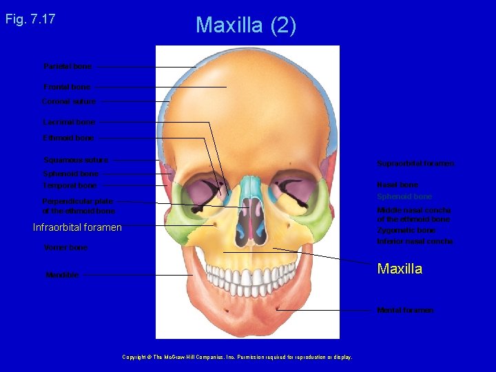 Fig. 7. 17 Maxilla (2) Parietal bone Frontal bone Coronal suture Lacrimal bone Ethmoid