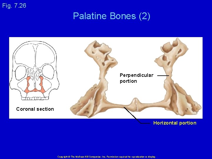 Fig. 7. 26 Palatine Bones (2) Perpendicular portion Coronal section Horizontal portion Copyright ©