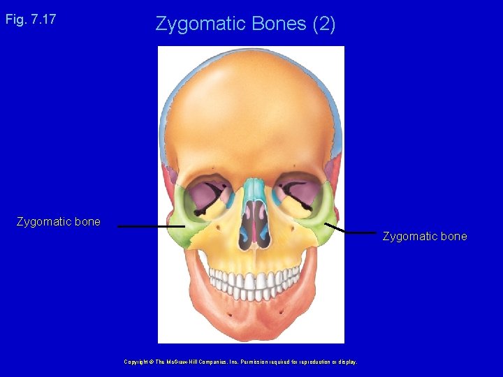 Fig. 7. 17 Zygomatic Bones (2) Zygomatic bone Copyright © The Mc. Graw-Hill Companies,