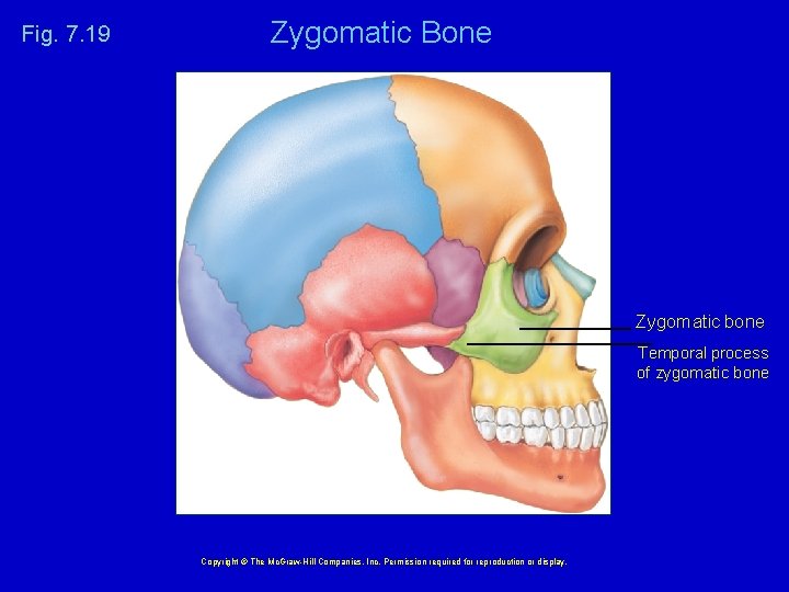 Fig. 7. 19 Zygomatic Bone Zygomatic bone Temporal process of zygomatic bone Copyright ©