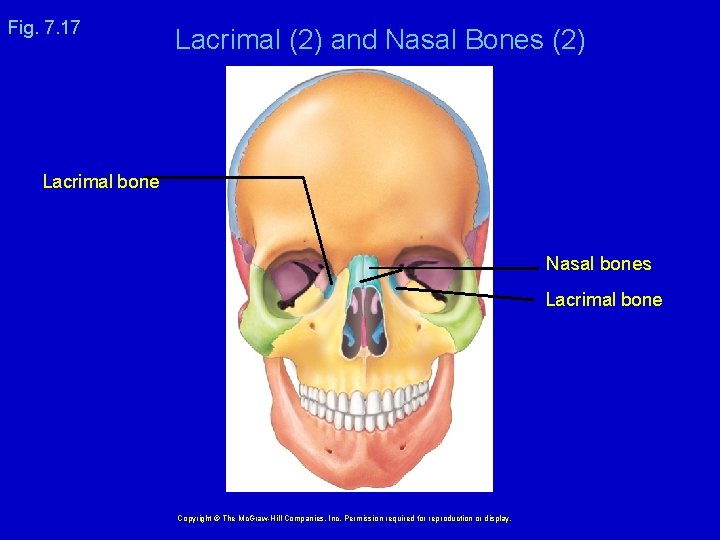 Fig. 7. 17 Lacrimal (2) and Nasal Bones (2) Lacrimal bone Nasal bones Lacrimal