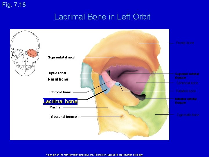 Fig. 7. 18 Lacrimal Bone in Left Orbit Frontal bone Supraorbital notch Optic canal