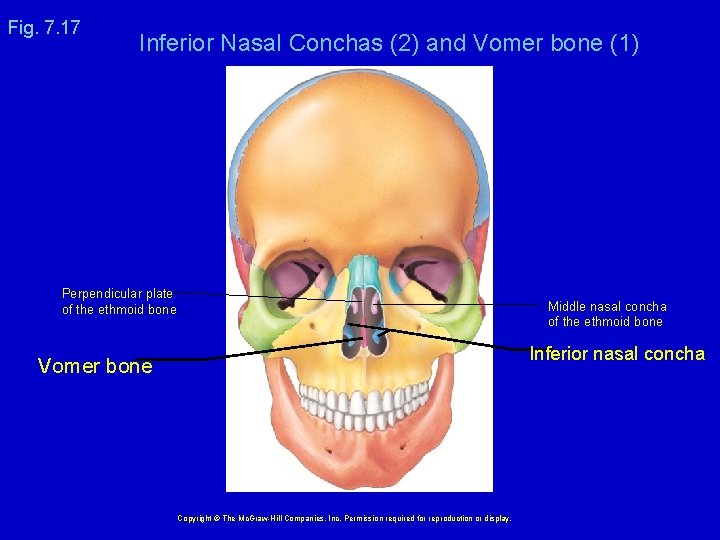 Fig. 7. 17 Inferior Nasal Conchas (2) and Vomer bone (1) Perpendicular plate of