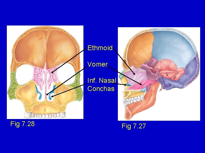 Ethmoid Vomer Inf. Nasal Conchas Fig 7. 28 Fig 7. 27 