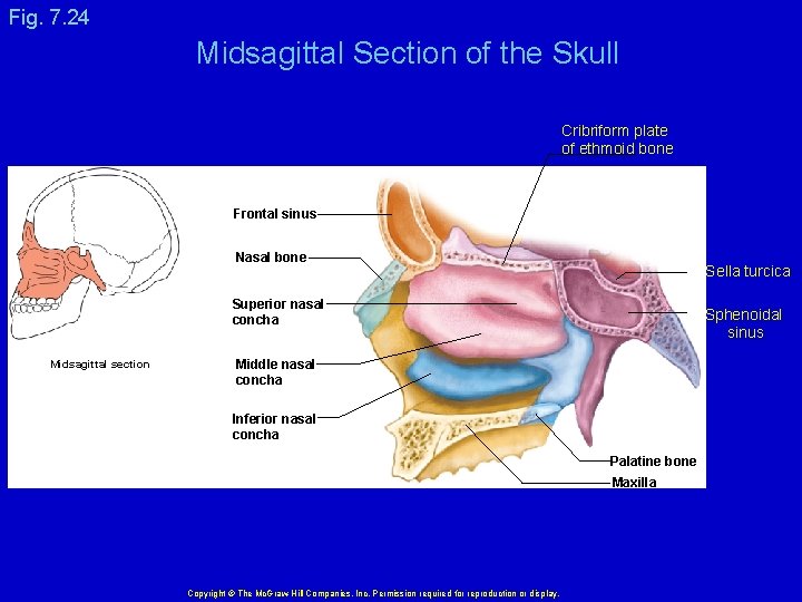 Fig. 7. 24 Midsagittal Section of the Skull Cribriform plate of ethmoid bone Frontal
