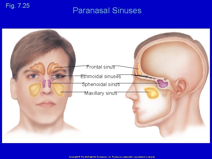 Fig. 7. 25 Paranasal Sinuses Frontal sinus Ethmoidal sinuses Sphenoidal sinus Maxillary sinus Copyright