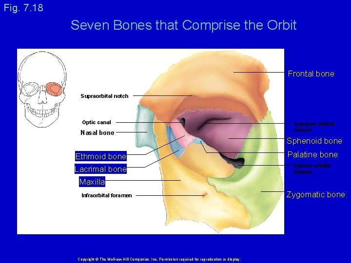 Fig. 7. 18 Seven Bones that Comprise the Orbit Frontal bone Supraorbital notch Optic