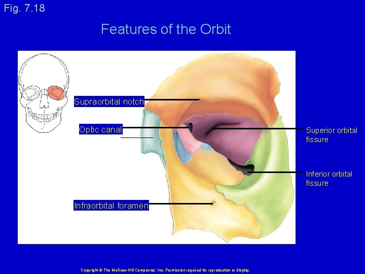 Fig. 7. 18 Features of the Orbit Supraorbital notch Optic canal Superior orbital fissure