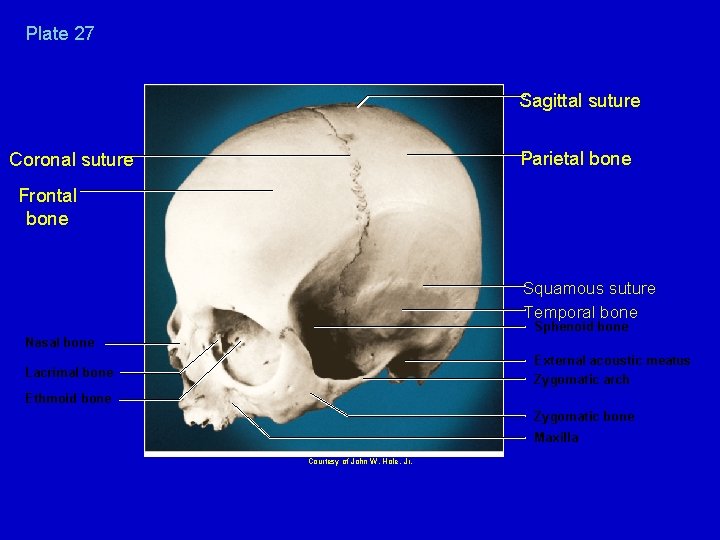 Plate 27 Sagittal suture Parietal bone Coronal suture Frontal bone Squamous suture Temporal bone