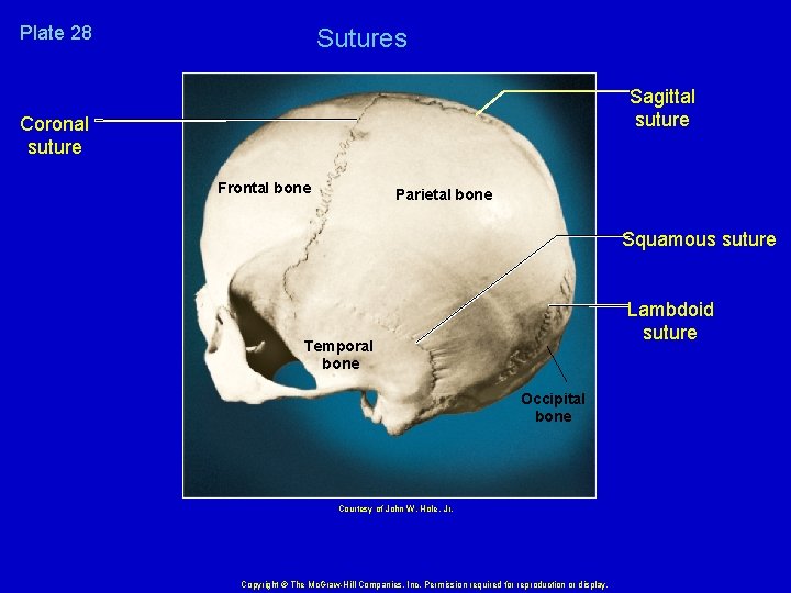 Plate 28 Coronal suture Sutures Plate 7. 28 Frontal bone Sagittal suture Parietal bone