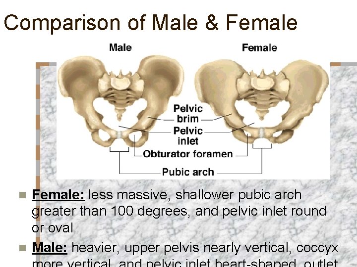 Comparison of Male & Female: less massive, shallower pubic arch greater than 100 degrees,