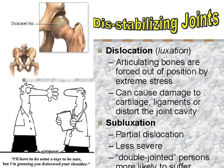 Dislocation (luxation) – Articulating bones are forced out of position by extreme stress –