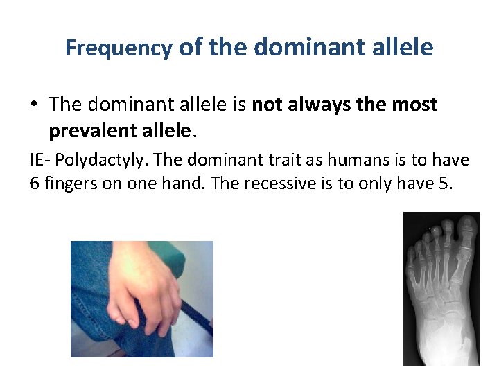 Frequency of the dominant allele • The dominant allele is not always the most