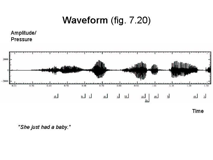 Waveform (fig. 7. 20) Amplitude/ Pressure Time "She just had a baby. " 