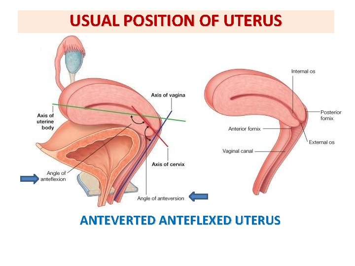 USUAL POSITION OF UTERUS ANTEVERTED ANTEFLEXED UTERUS USUAL POSITION OF UTERUS ANTEVERTED ANTEFLEXED UTERUS