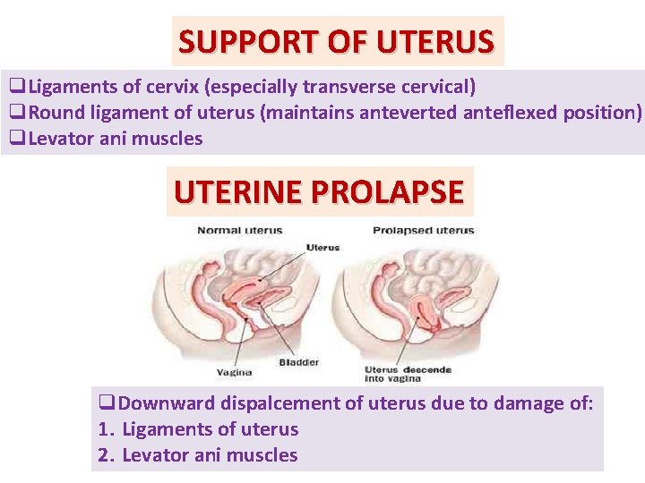 SUPPORT OF UTERUS q. Ligaments of cervix (especially transverse cervical) q. Round ligament of SUPPORT OF UTERUS q. Ligaments of cervix (especially transverse cervical) q. Round ligament of