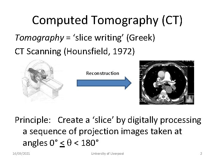 Computed Tomography (CT) Tomography = ‘slice writing’ (Greek) CT Scanning (Hounsfield, 1972) Reconstruction Principle: