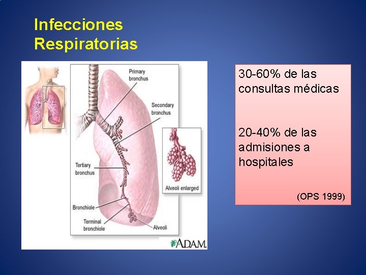 Infecciones Respiratorias 30 -60% de las consultas médicas 20 -40% de las admisiones a
