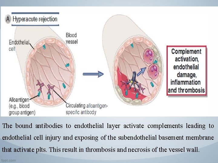 The bound antibodies to endothelial layer activate complements leading to endothelial cell injury and